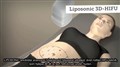 0 liposonic leilasspa.jpg